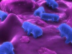 美国威斯康星州发生沙门氏菌疫情 超60人感染